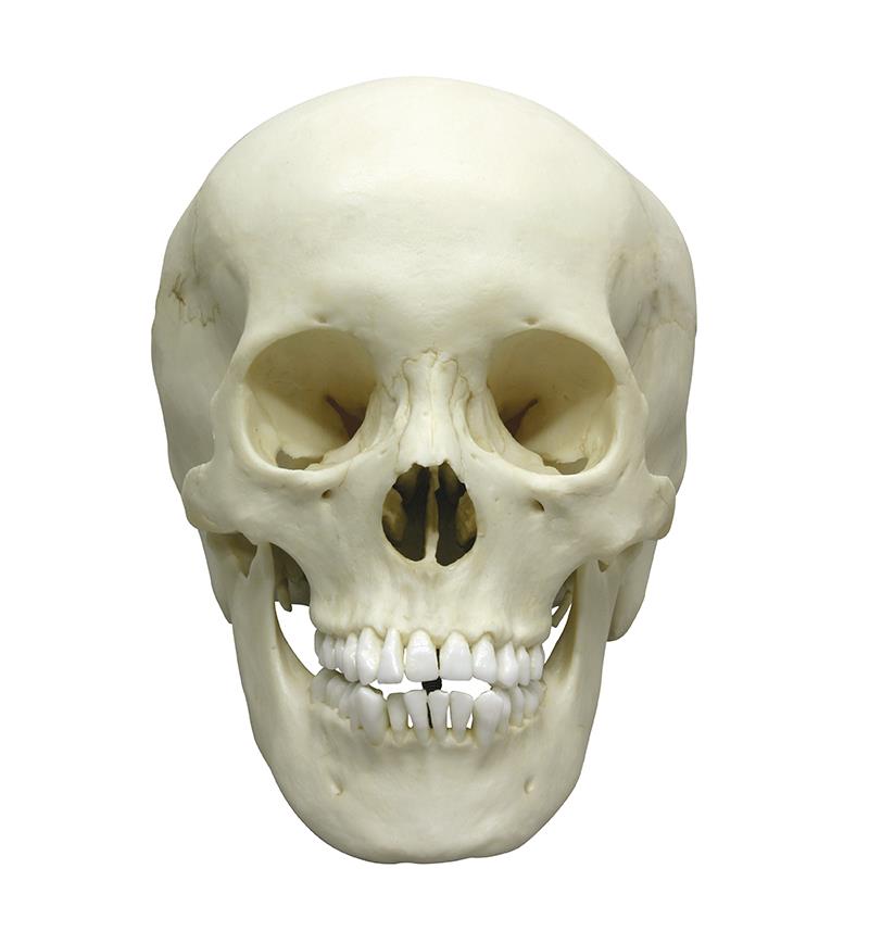 Adolescent skull, female