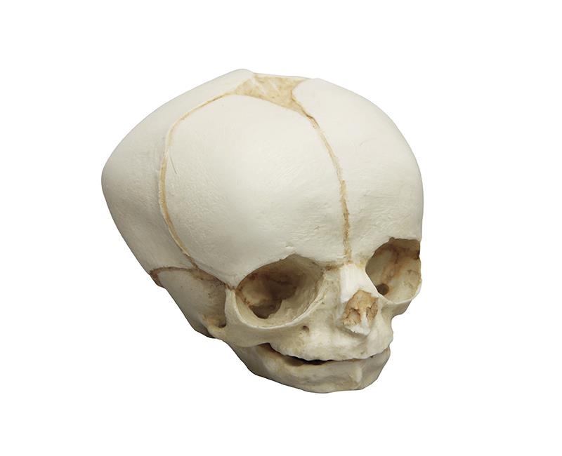 Fetal skull 30 weeks