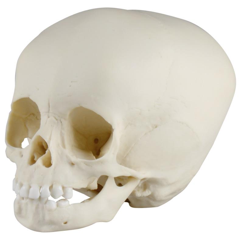 Child skull, 15 months old