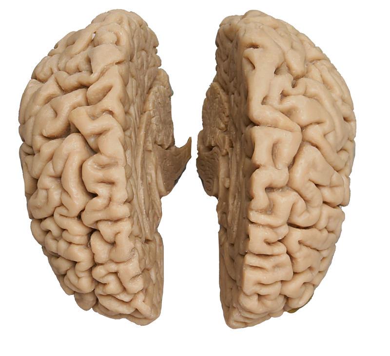 Menschliches Gehirn, Naturabguss