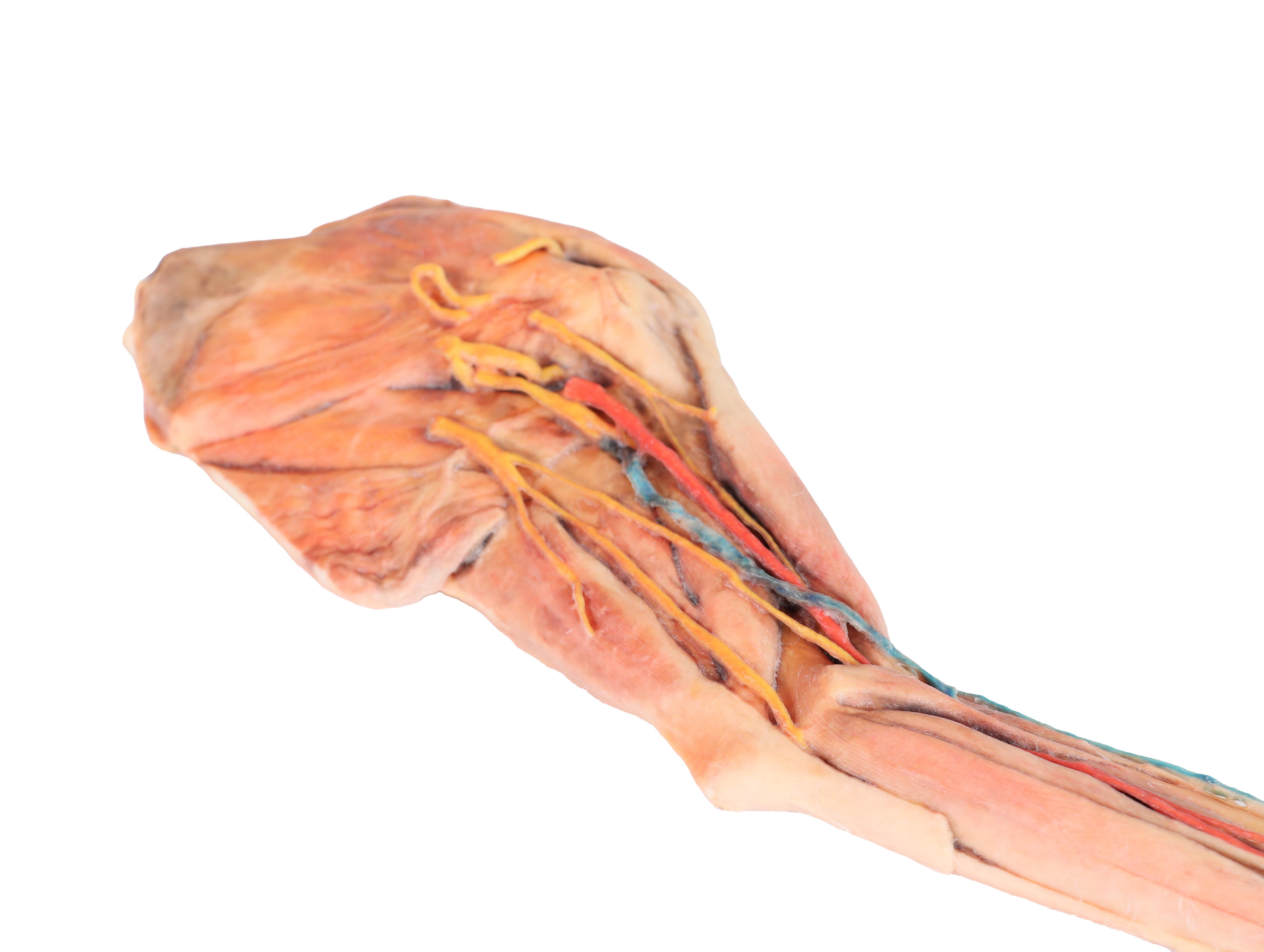 Dog-forelimb---muscles,-tendons,-ligaments,-vessels-and-nerves-distal-to-the-elbow-3