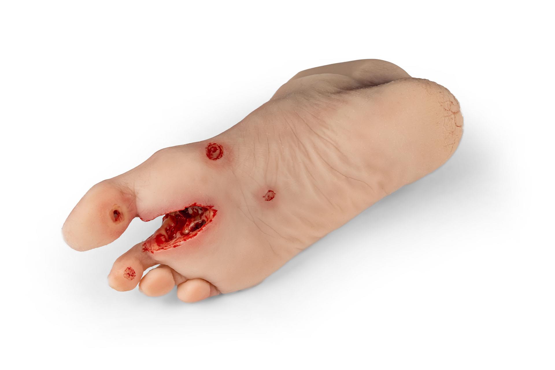 Wound-foot-with-diabetic-foot-syndrome-severe-stage-manikin-version-4