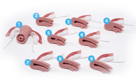 Uteri mit normalen und abnormalen inneren Pathologien für R10188