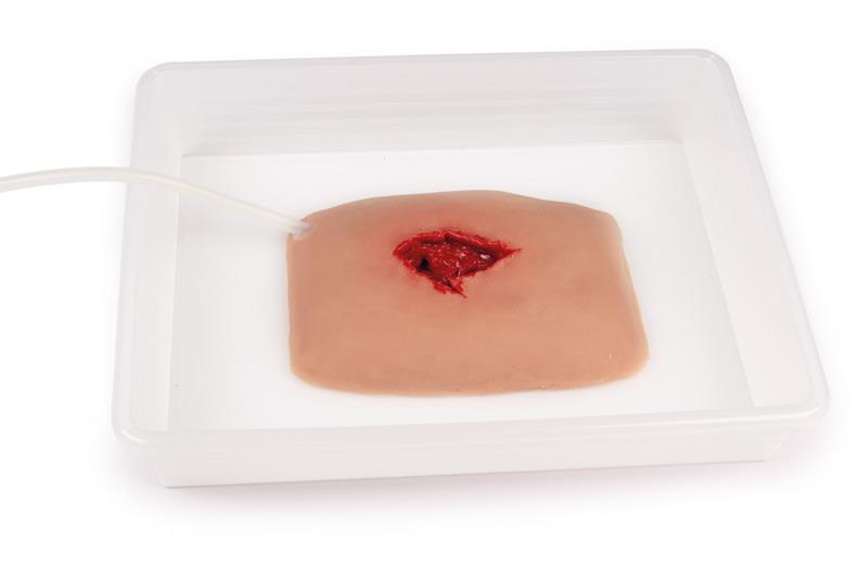 Wound moulage wound packing
