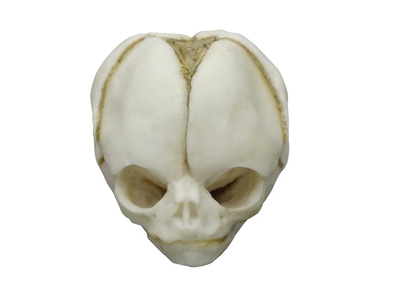Fetal skull 20 weeks