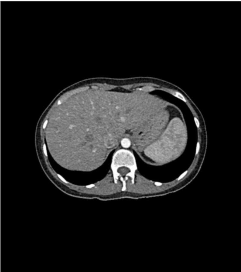 Abdomen-Phantom-für-CT-Röntgen-und-Strahlentherapie-1