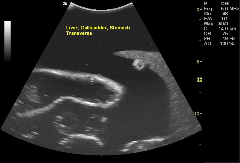 Adult-Torso-for-X-Ray-CT-and-US-11 Adult-Torso-for-X-Ray-CT-and-US-11