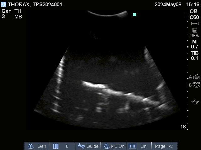 Adult-Thorax-for-X-Ray-CT-and-US-4 Adult-Thorax-for-X-Ray-CT-and-US-4