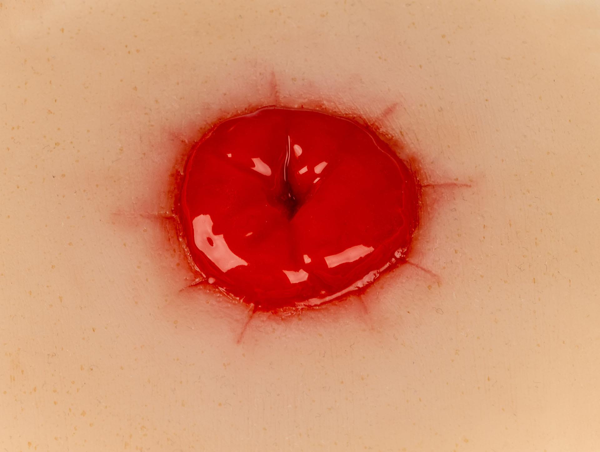 Wound-Moulage-Colostoma-incl-stand-2