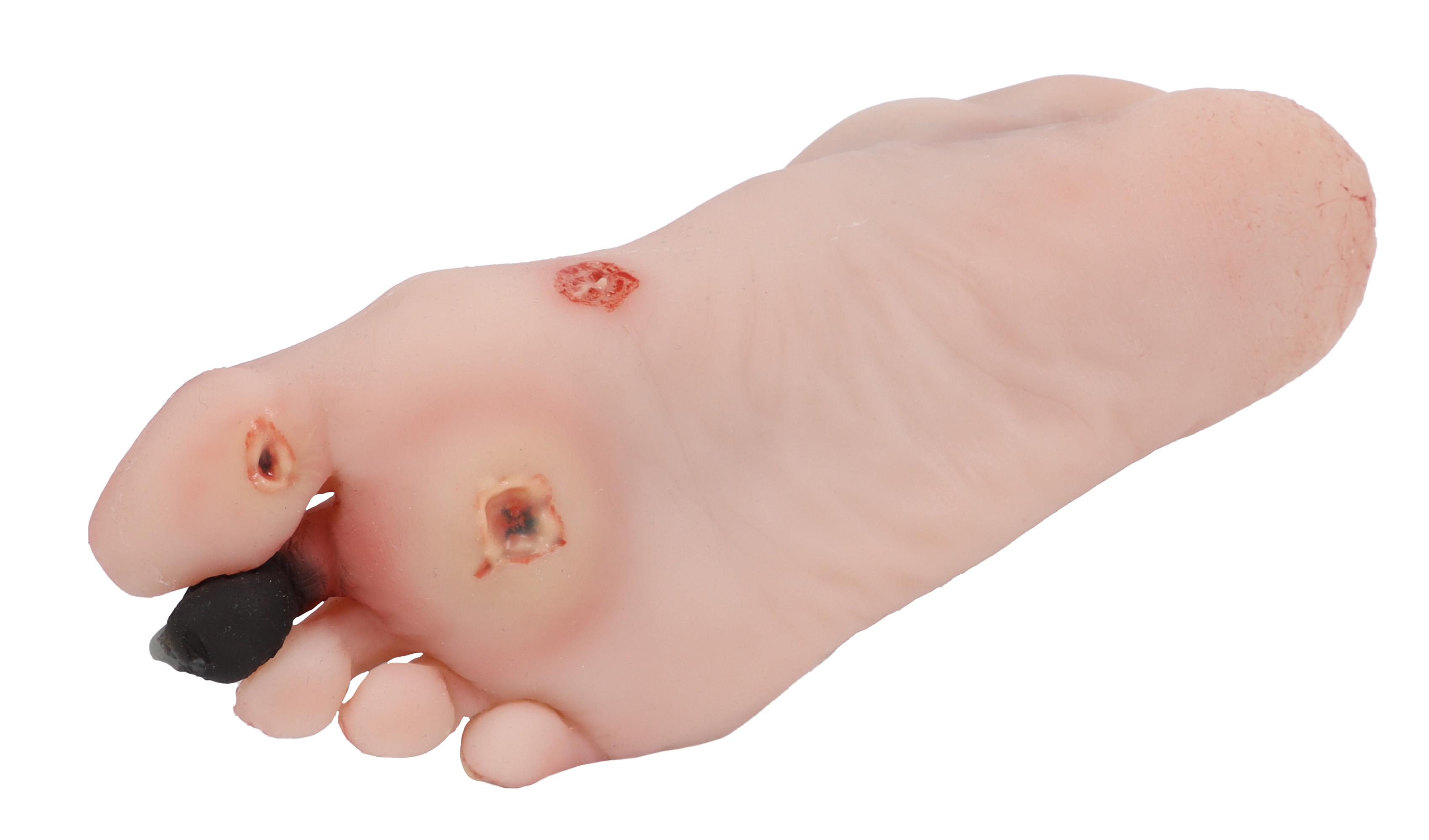 Wound-foot-with-diabetic-foot-syndrome-manikin-version-4