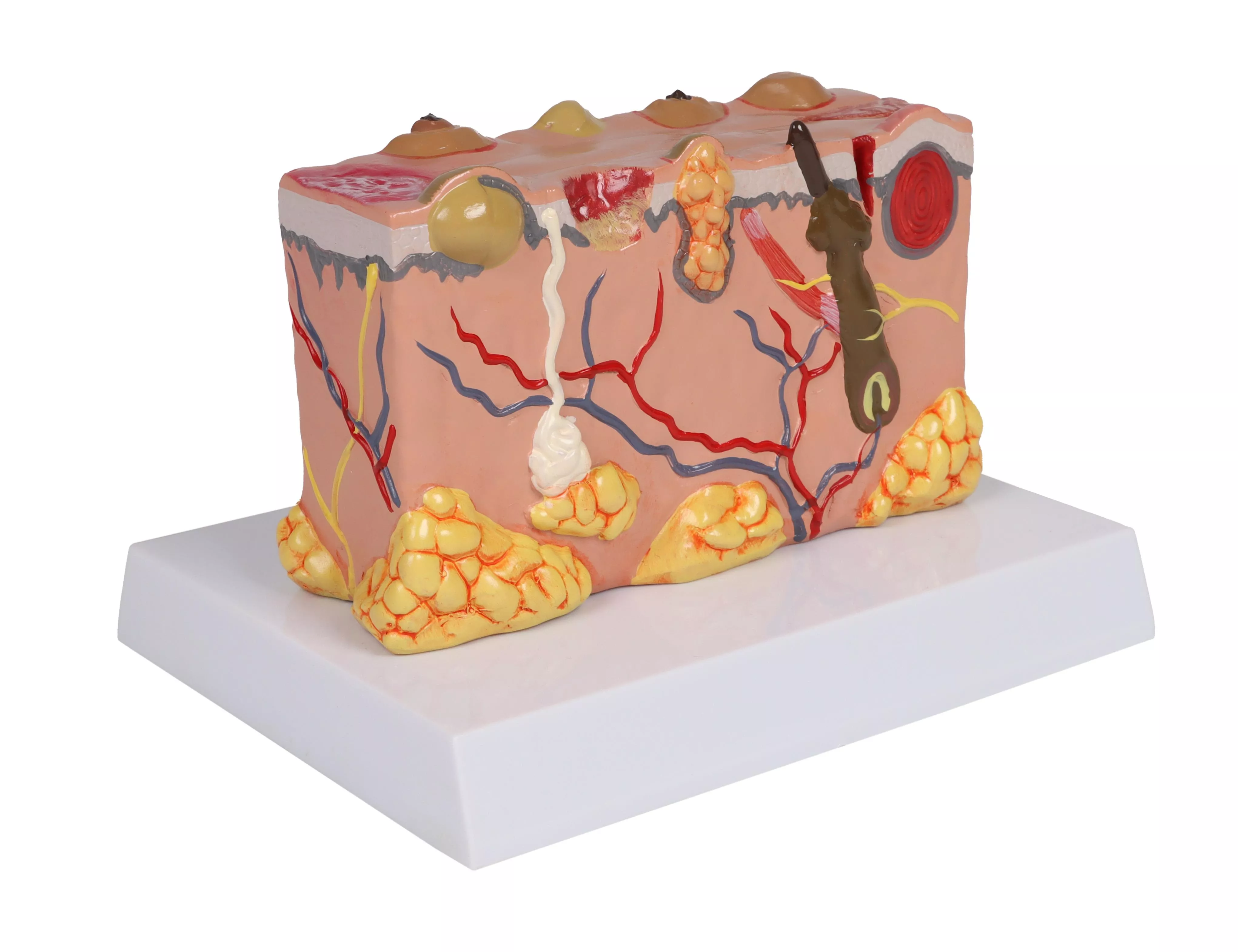 Pathologisches-Hautmodell-3
