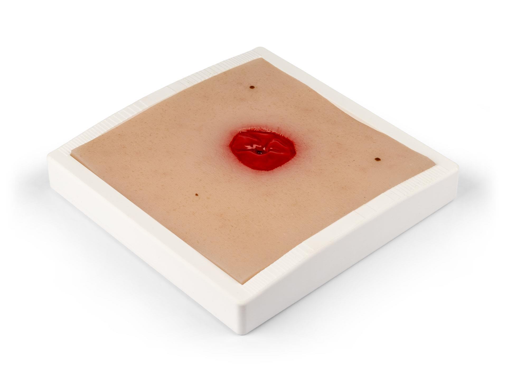 Wound-Moulage-Colostoma-under-skin-level-incl-stand