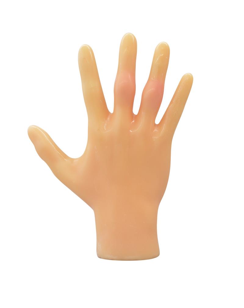 Rheumatoid Finger Phantom
