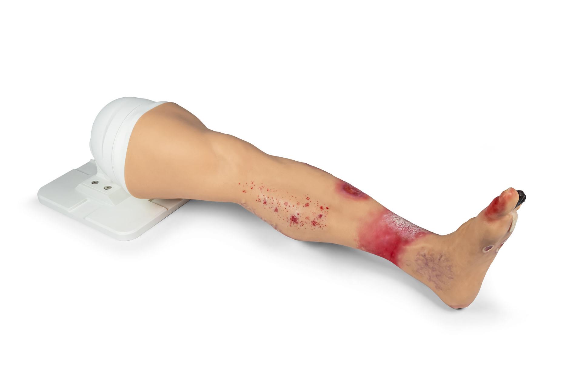 Lena-Leg-Jambe-atteinte-de-maladies-1