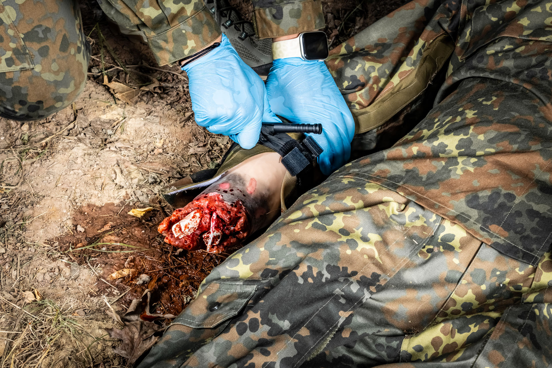 Amputationsstumpf Arm rechts, Combat Carl action