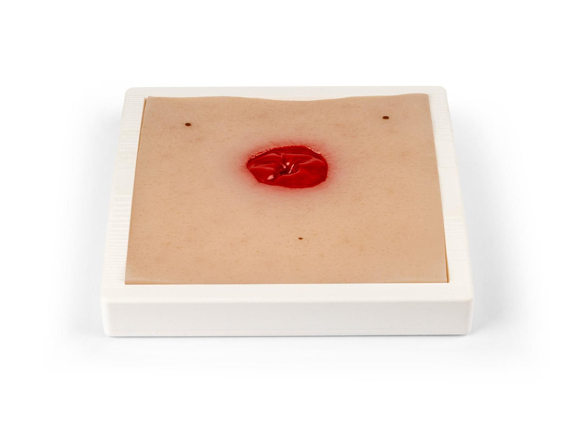 Wound-Moulage-Colostoma-under-skin-level-incl-stand-1