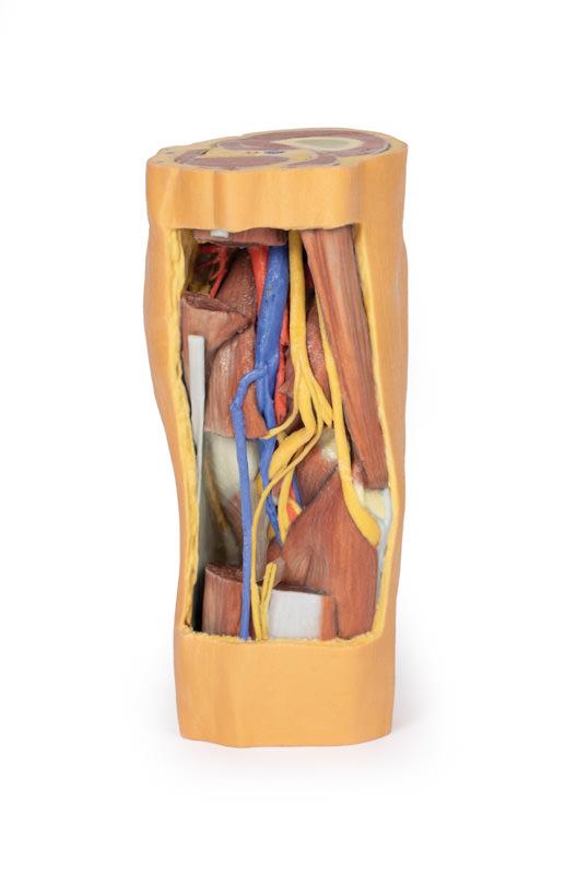 Popliteal Fossa distal thigh and proximal leg