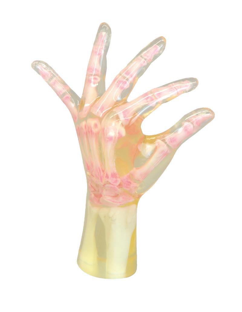 Röntgen-Teilphantom mit künstlichen Knochen - Linke Hand, transparent