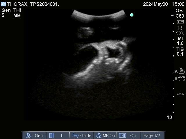 Adult-Thorax-for-X-Ray-CT-and-US-3 Adult-Thorax-for-X-Ray-CT-and-US-3