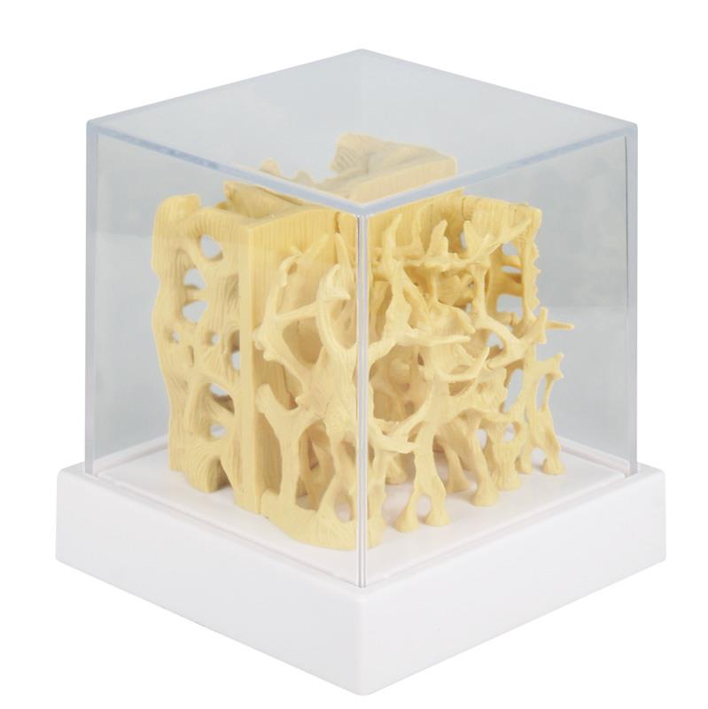 Healthy / osteoporotic bone structure comparison model