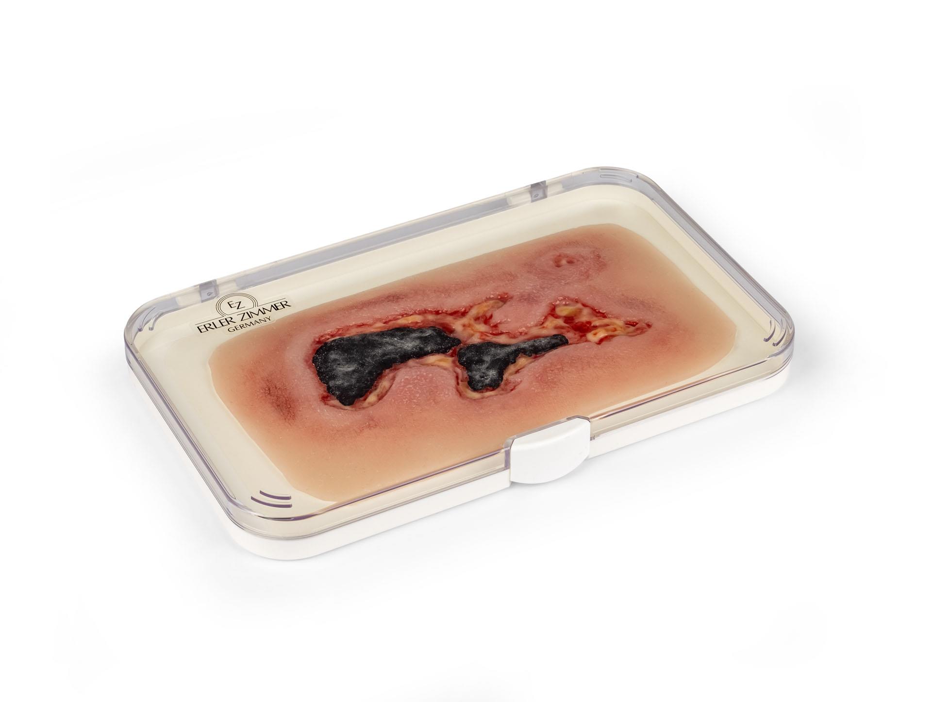 Wound-moulage-arterial-leg-ulcer-small-exudation-phase-1