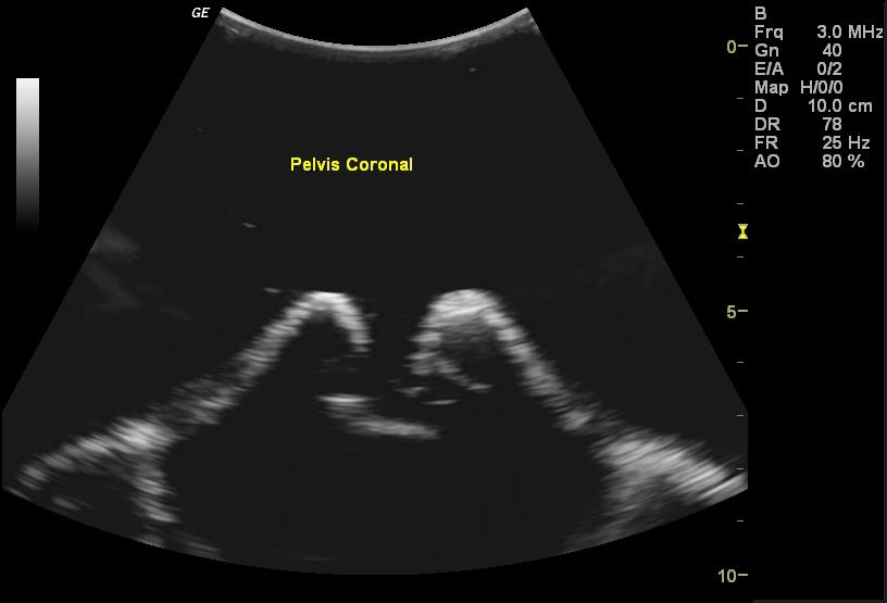 Adult-Torso-for-X-Ray-CT-and-US-4 Adult-Torso-for-X-Ray-CT-and-US-4