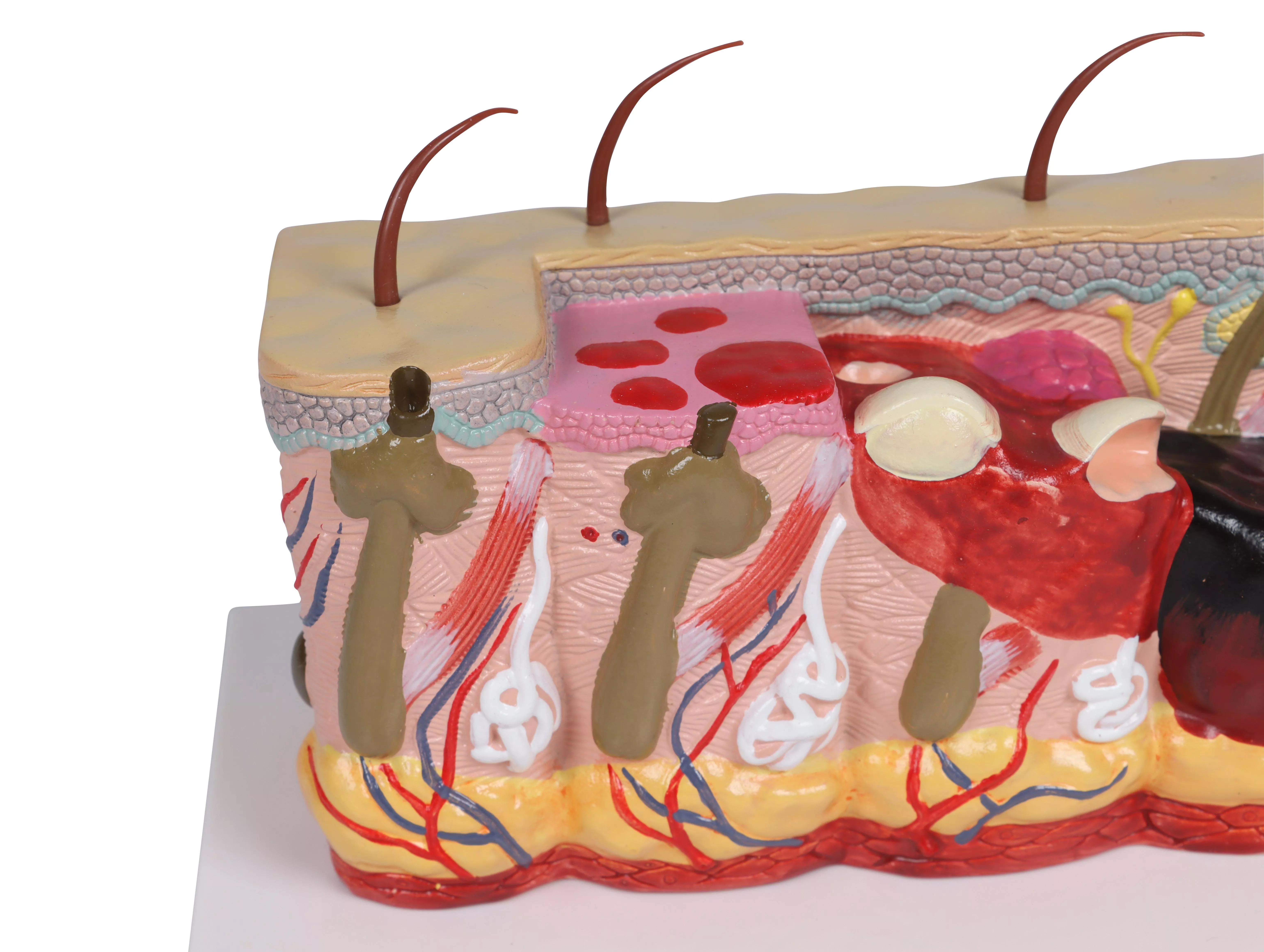 Pathologisches-Hautmodell-mit-Verbrennung-30-fache-Größe-3