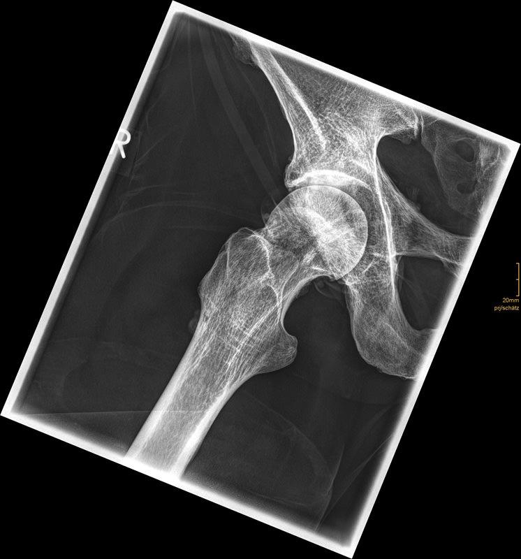 Röntgenphantom-Hüfte-flexibel-4