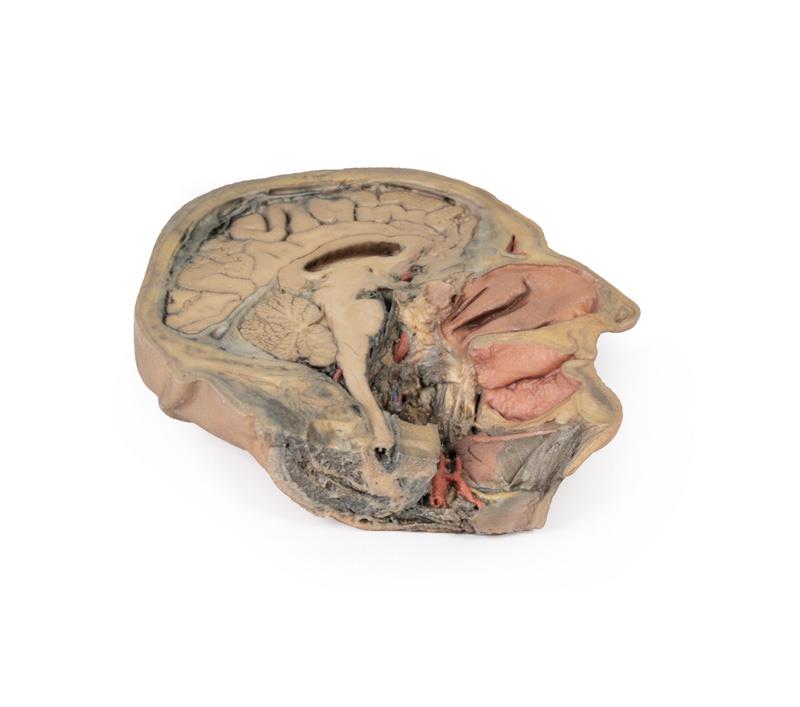 Median Section through head sagittal section of head with deep dissection