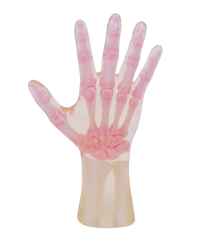 Röntgen-Teilphantom mit künstlichen Knochen - Rechte Hand, transparent