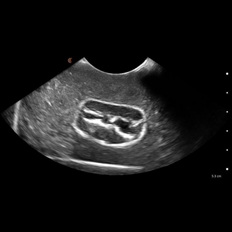 Lillie-Canine-Ultrasound-Phantom-Training-Kit-15