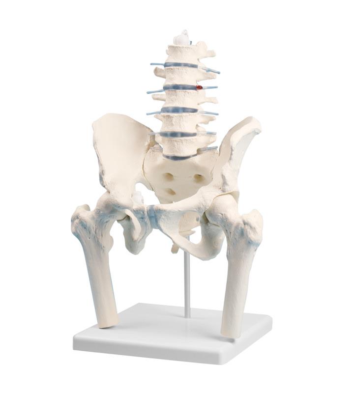 Lumbar spine with pelvis and femoral stumps