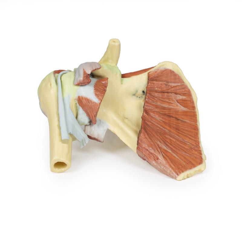 Schulter – tiefe Präparation eines rechten Schultergürtels, bei Erhaltung des vollst. Schulterblatts