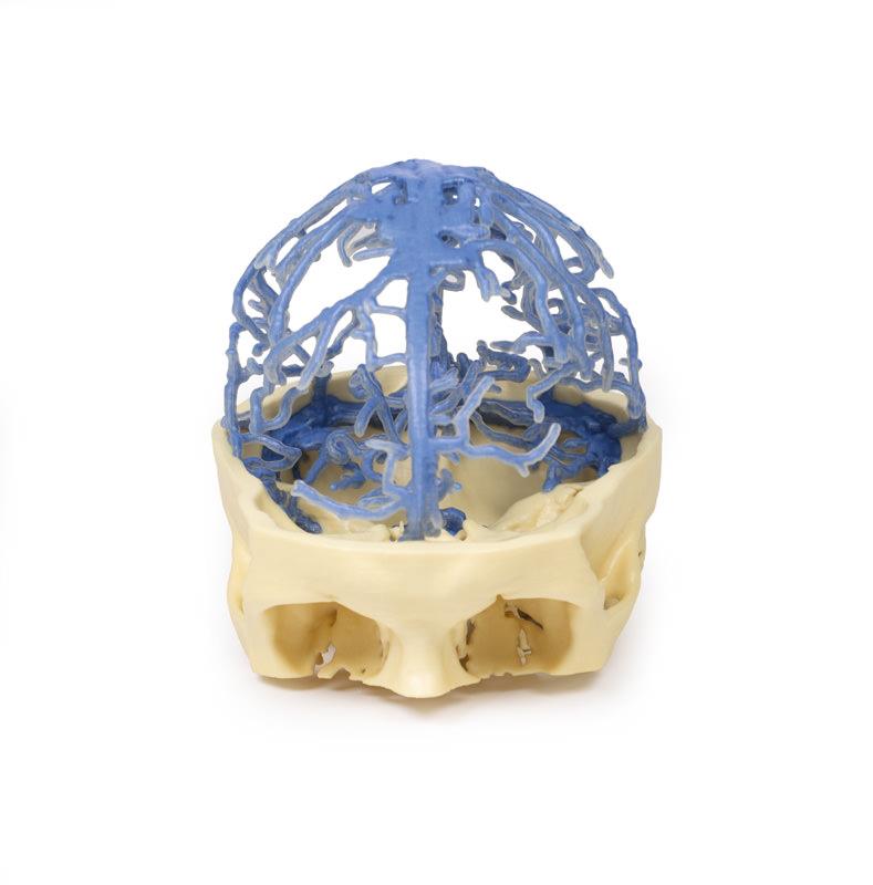 3D Printed Anatomy - Venous Circulation