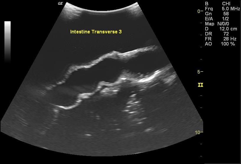 Adult-Torso-for-X-Ray-CT-and-US-8 Adult-Torso-for-X-Ray-CT-and-US-8