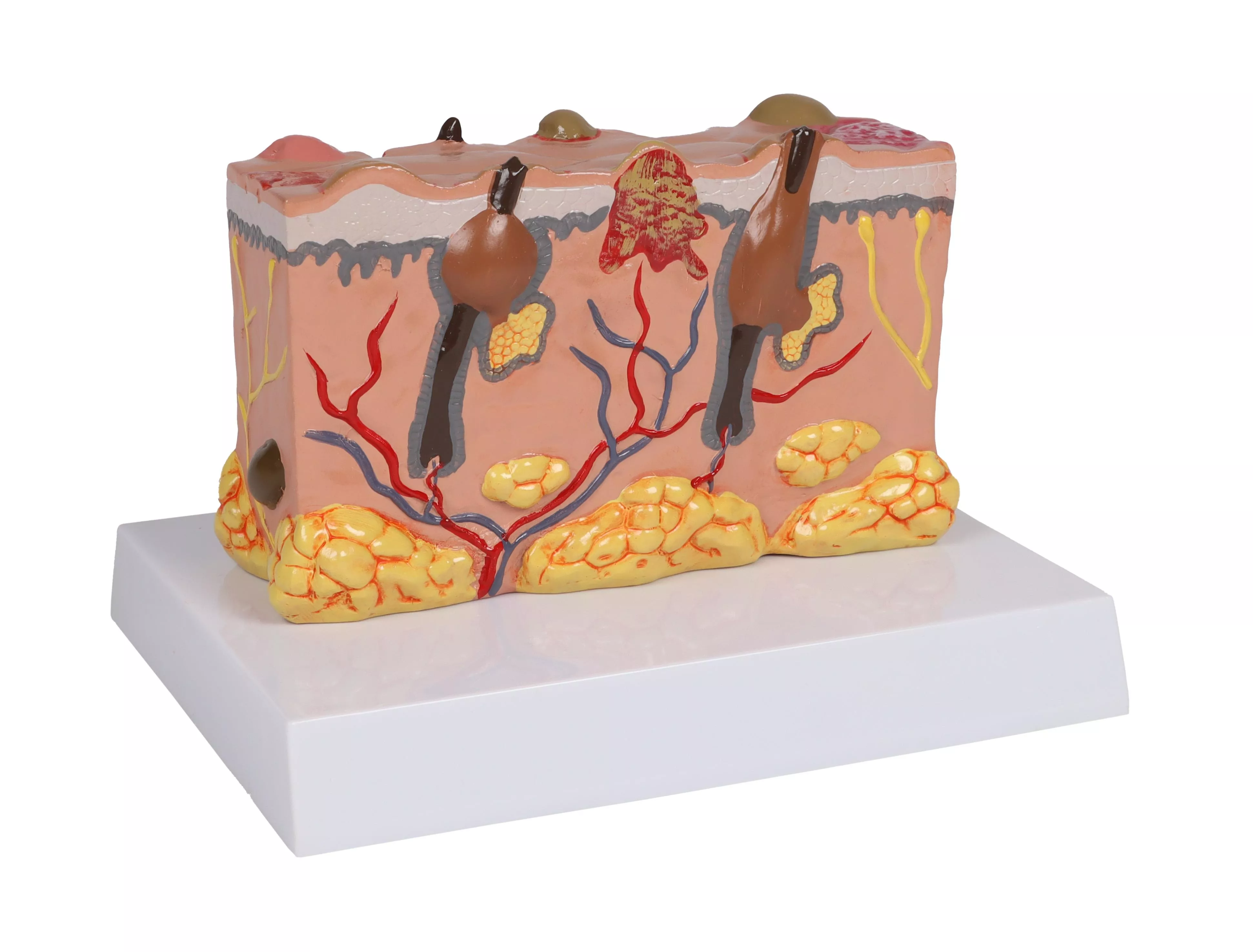 Pathologisches-Hautmodell-1