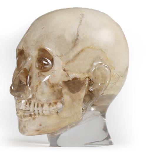 X-ray phantom head, transparent