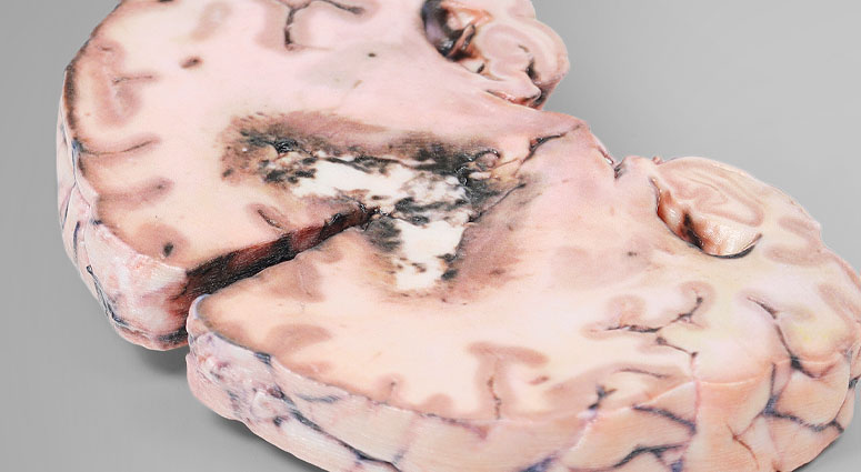 3D Anatomie Modelle