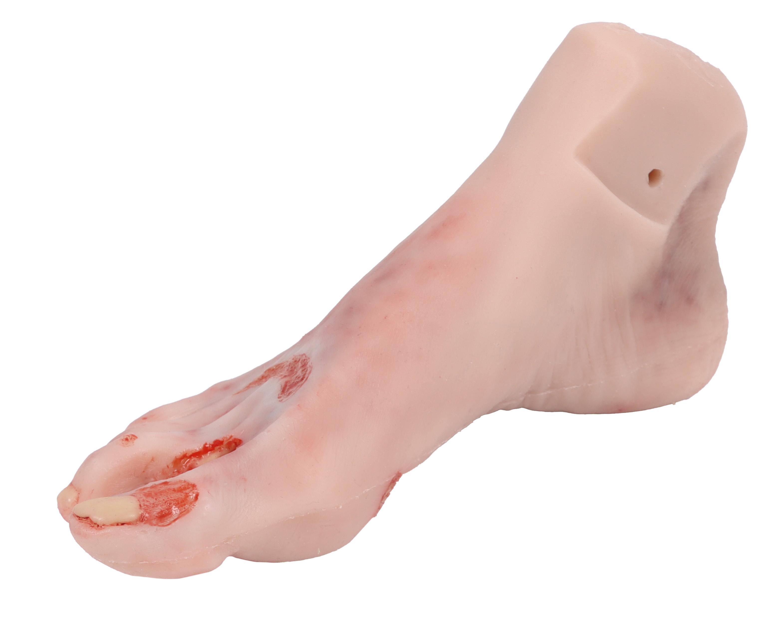 Wound-foot-with-diabetic-foot-syndrome-severe-stage-manikin-version-3