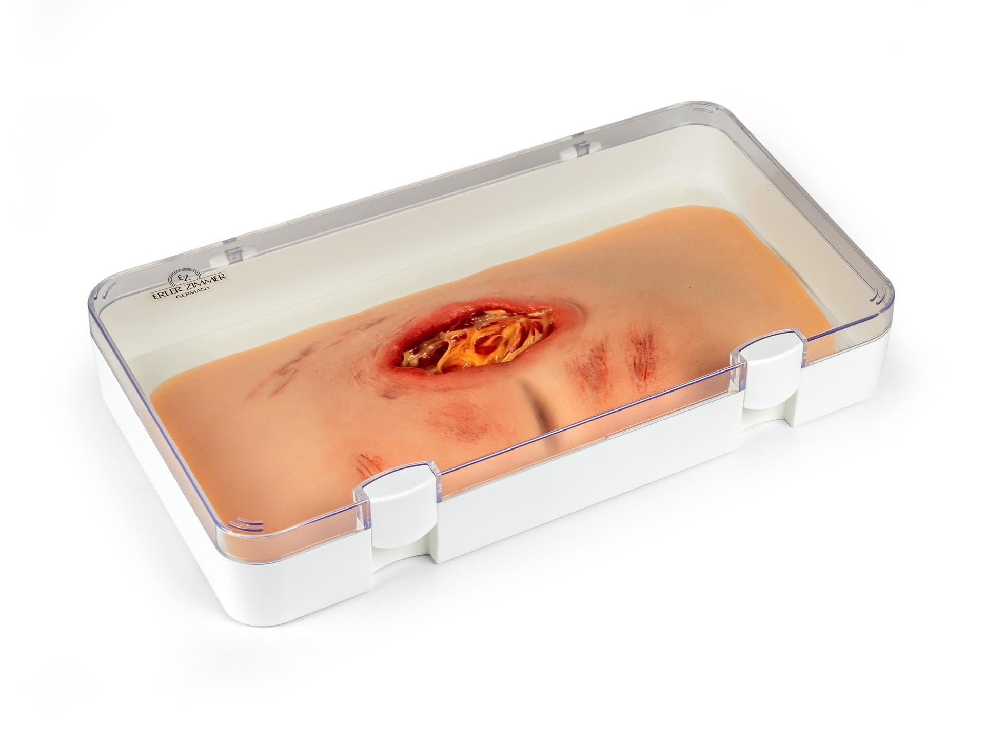 Wound-moulage-sacral-decubitus-cleaned-1