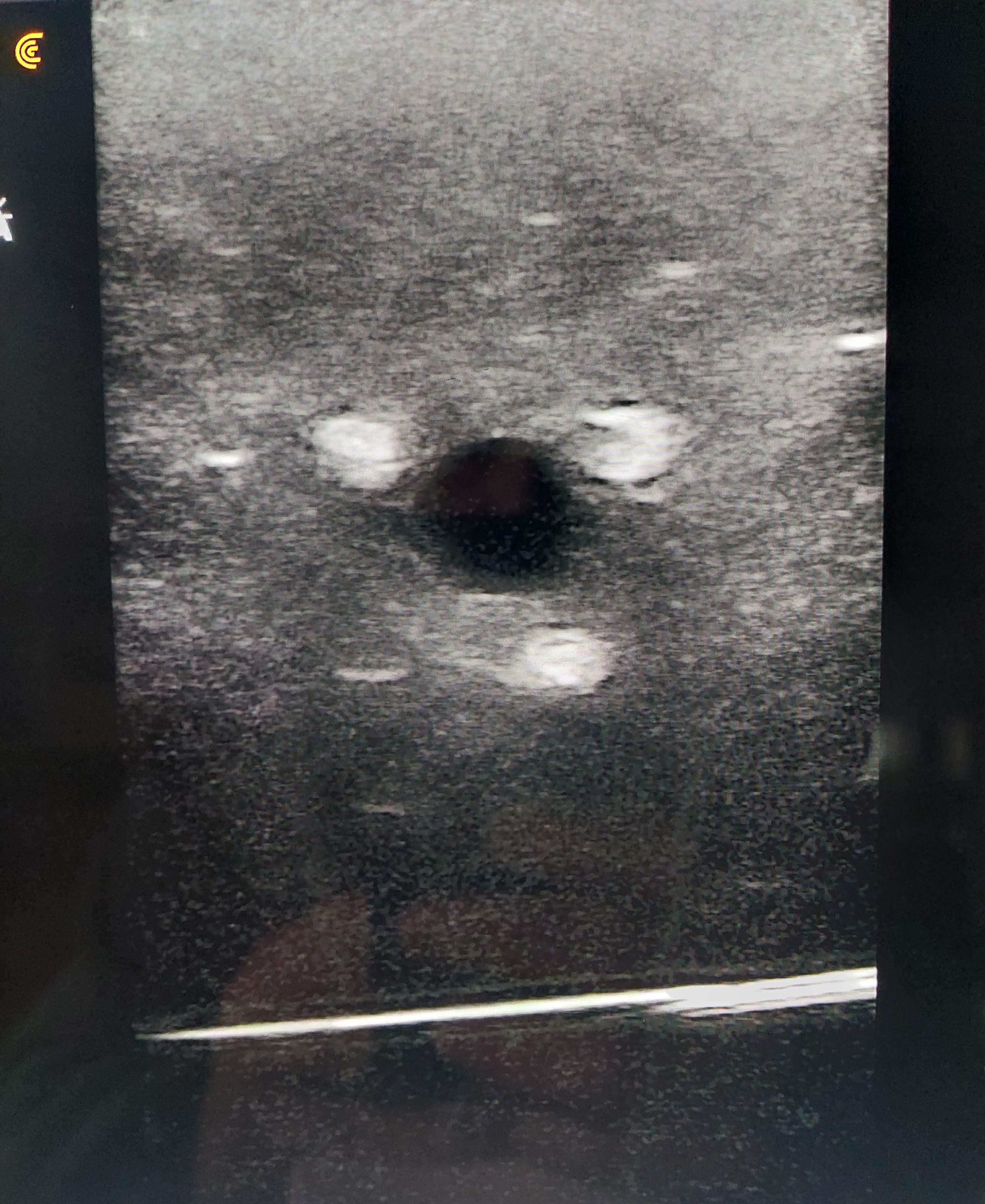 Ultrasound---Regional-Anesthesia---Simulator-3