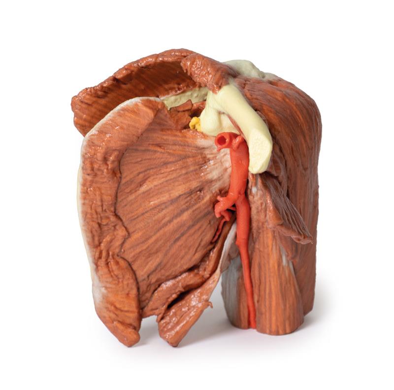 Schulter (links) – Oberflächliche Muskeln mit Arteria axillaris/brachialis