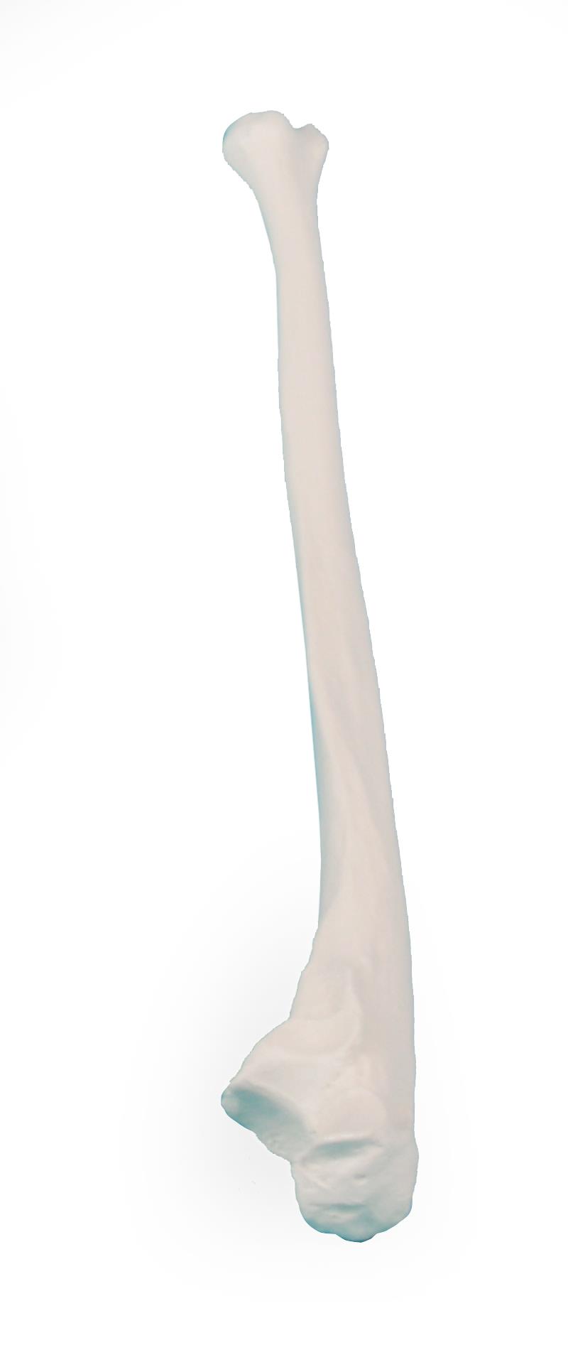 Ulna (Elle)