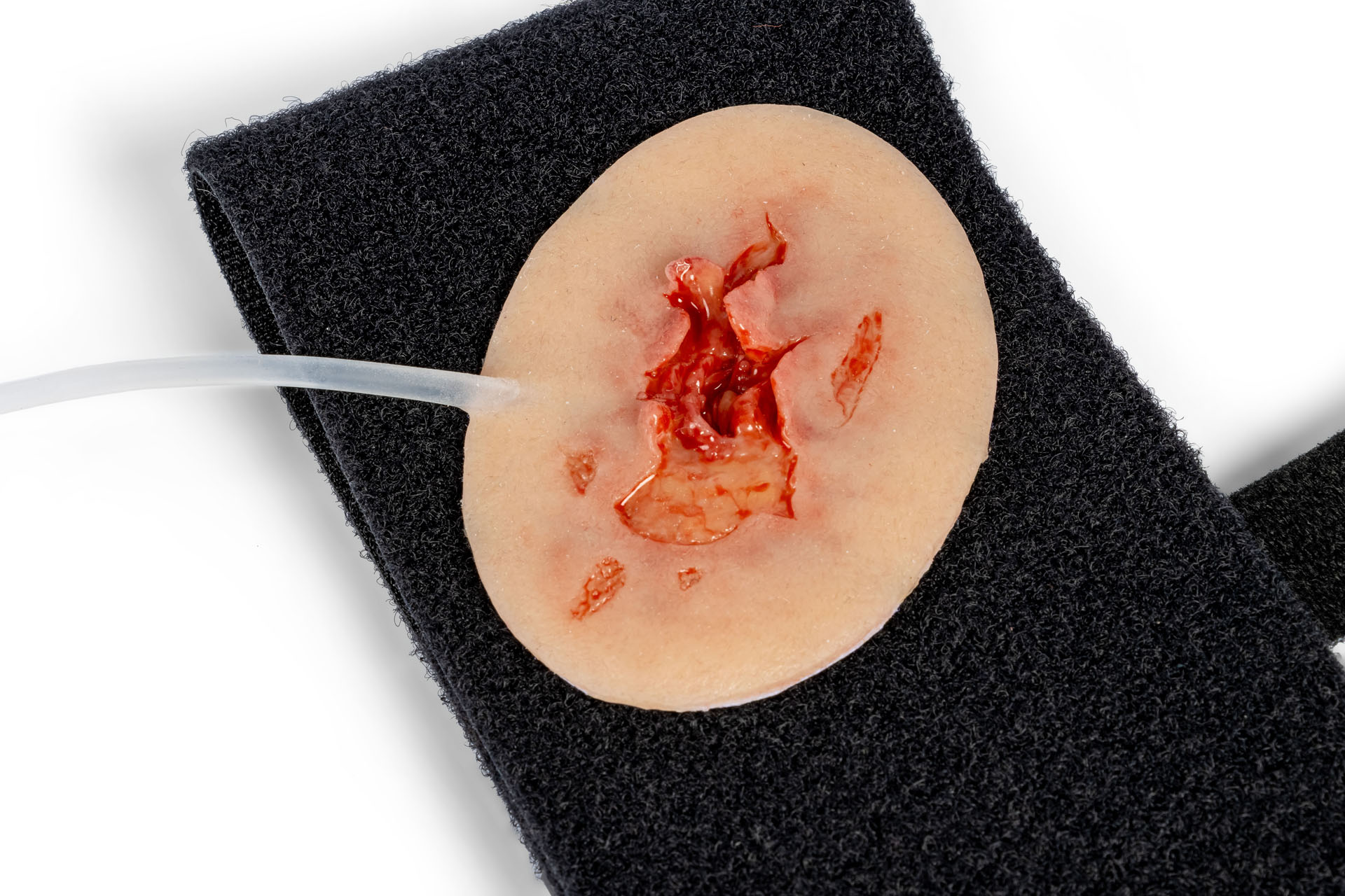 Wound moulage axillary injury with velcro