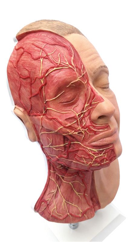 Head for facial injections with muscles, arteries and nerves