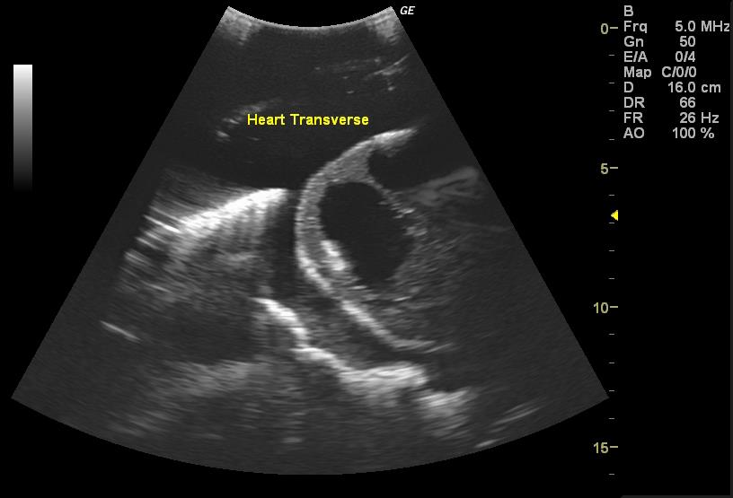Adult-Torso-for-X-Ray-CT-and-US-7 Adult-Torso-for-X-Ray-CT-and-US-7
