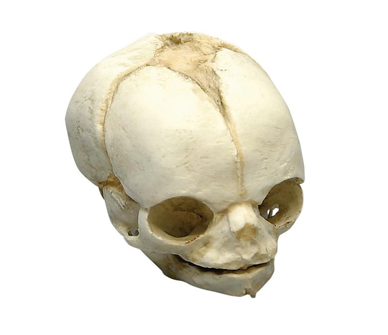 Fetal skull 21 ½ weeks