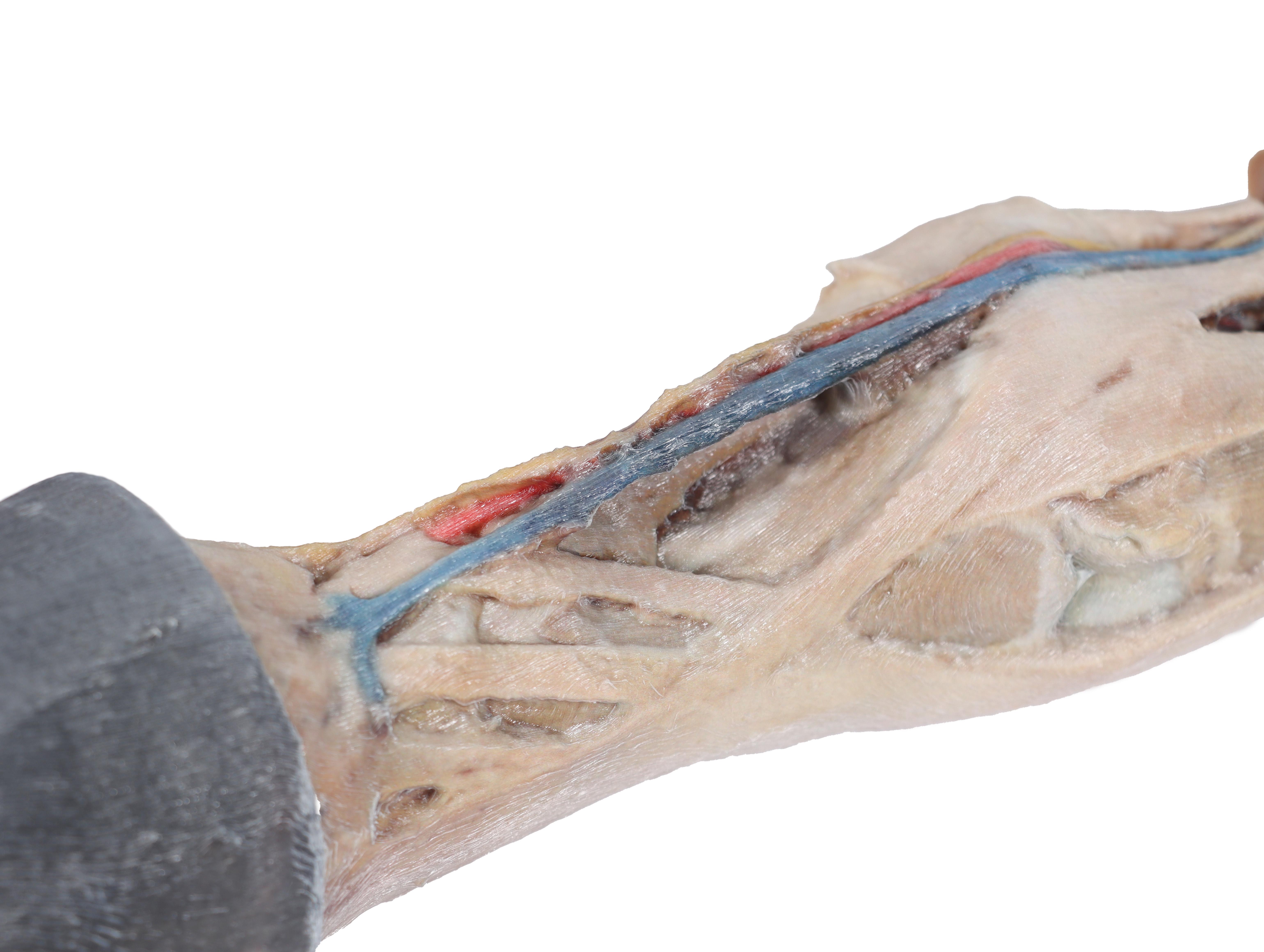 Horse-foot---tendons,-ligaments,-vessels-and-nerves-4