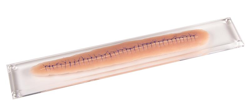 Surgical wound, with suture, 22cm