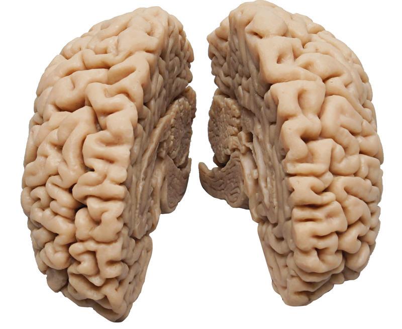 Human Brain, actual cast